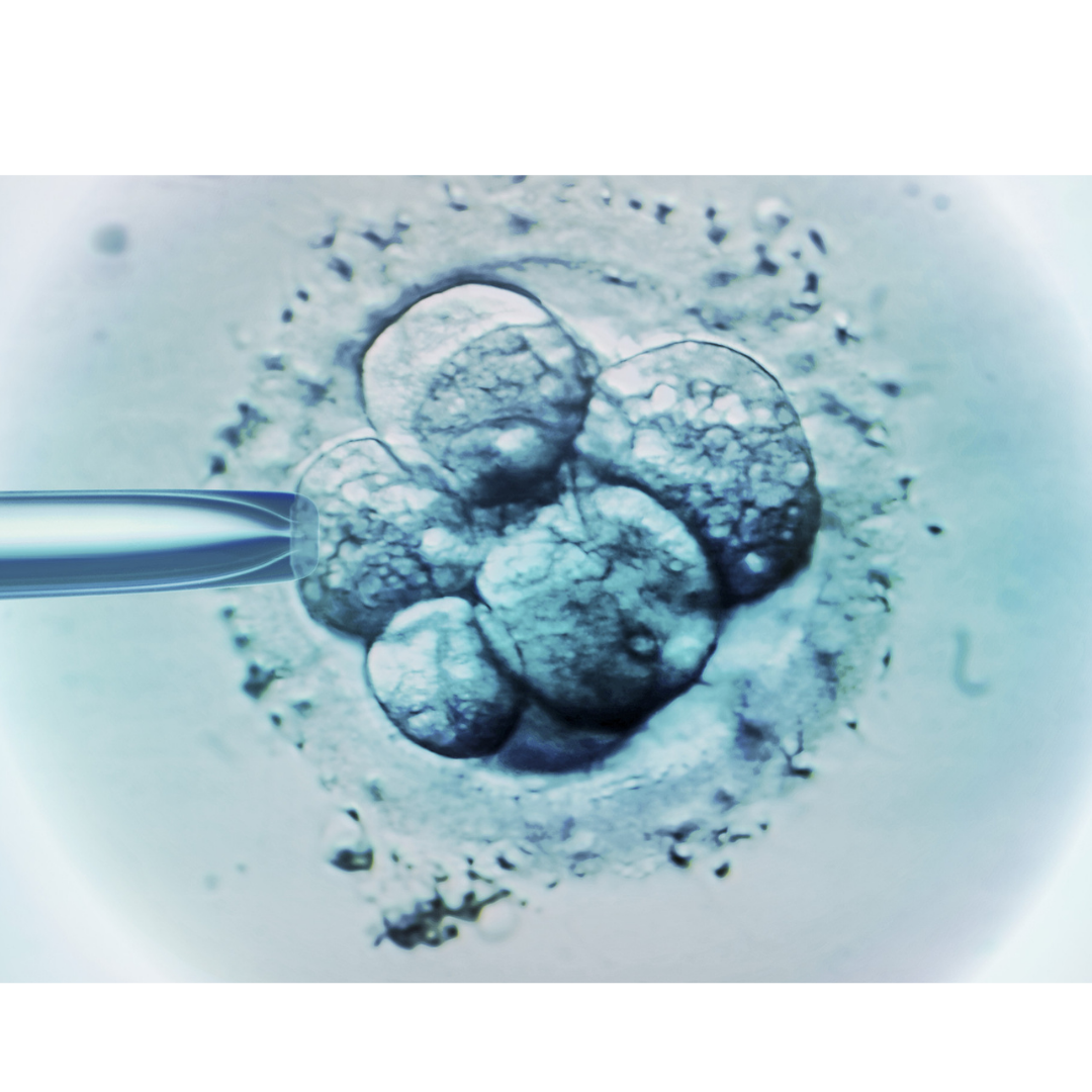 Questions about IVF